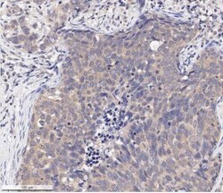 AKT1, p Ser473 Antibody (104A282) - BSA Free, Novus Biologicals:Antibodies:Primary